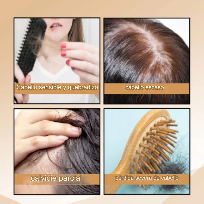 Shampoo y Acondicionador Can'nabis – Crecimiento y prevención de la calvicie prematura